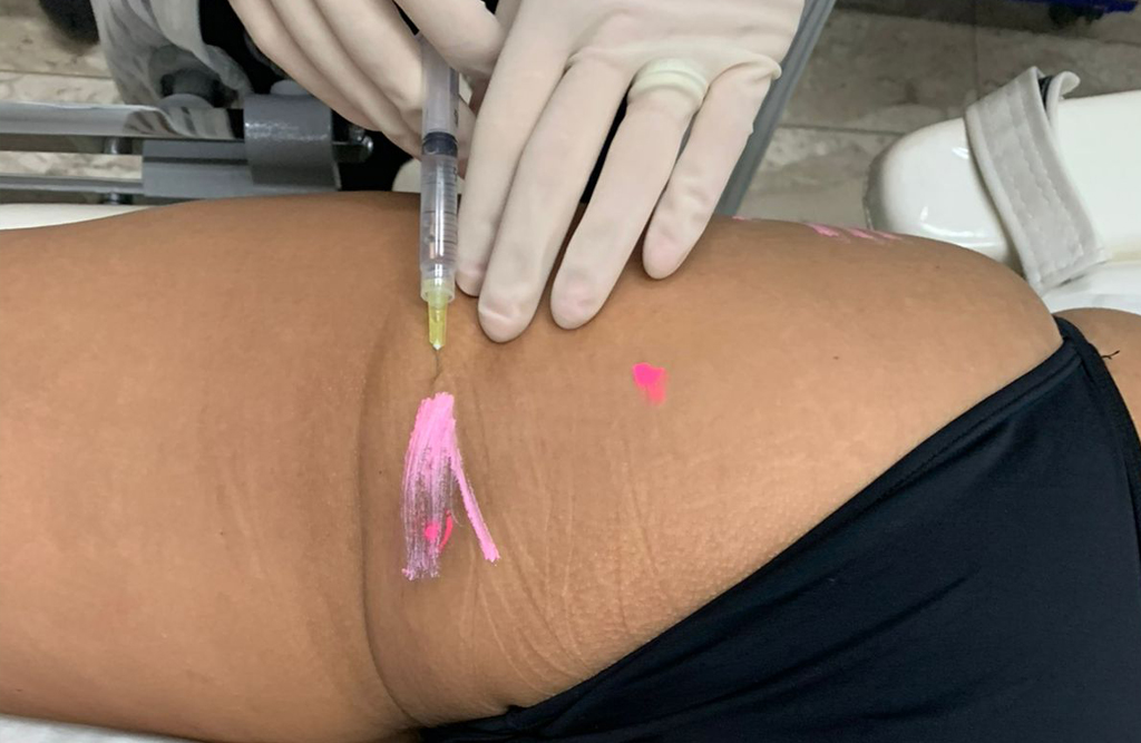 LL Dermatologia