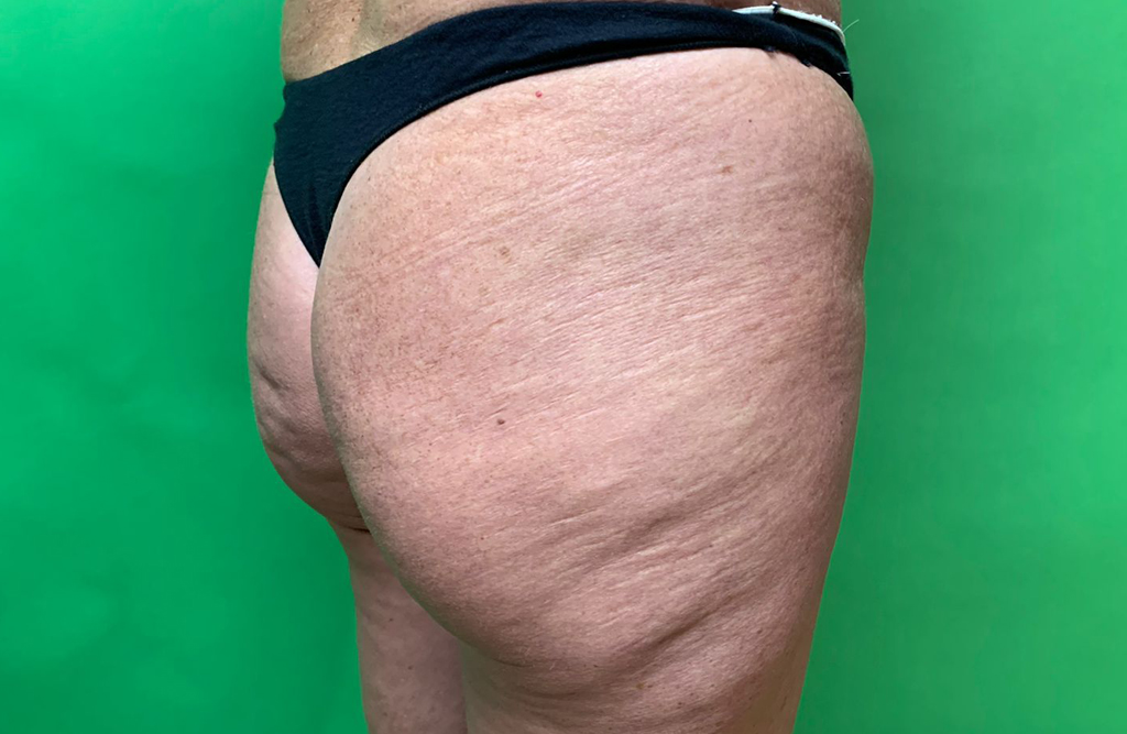 LL Dermatologia